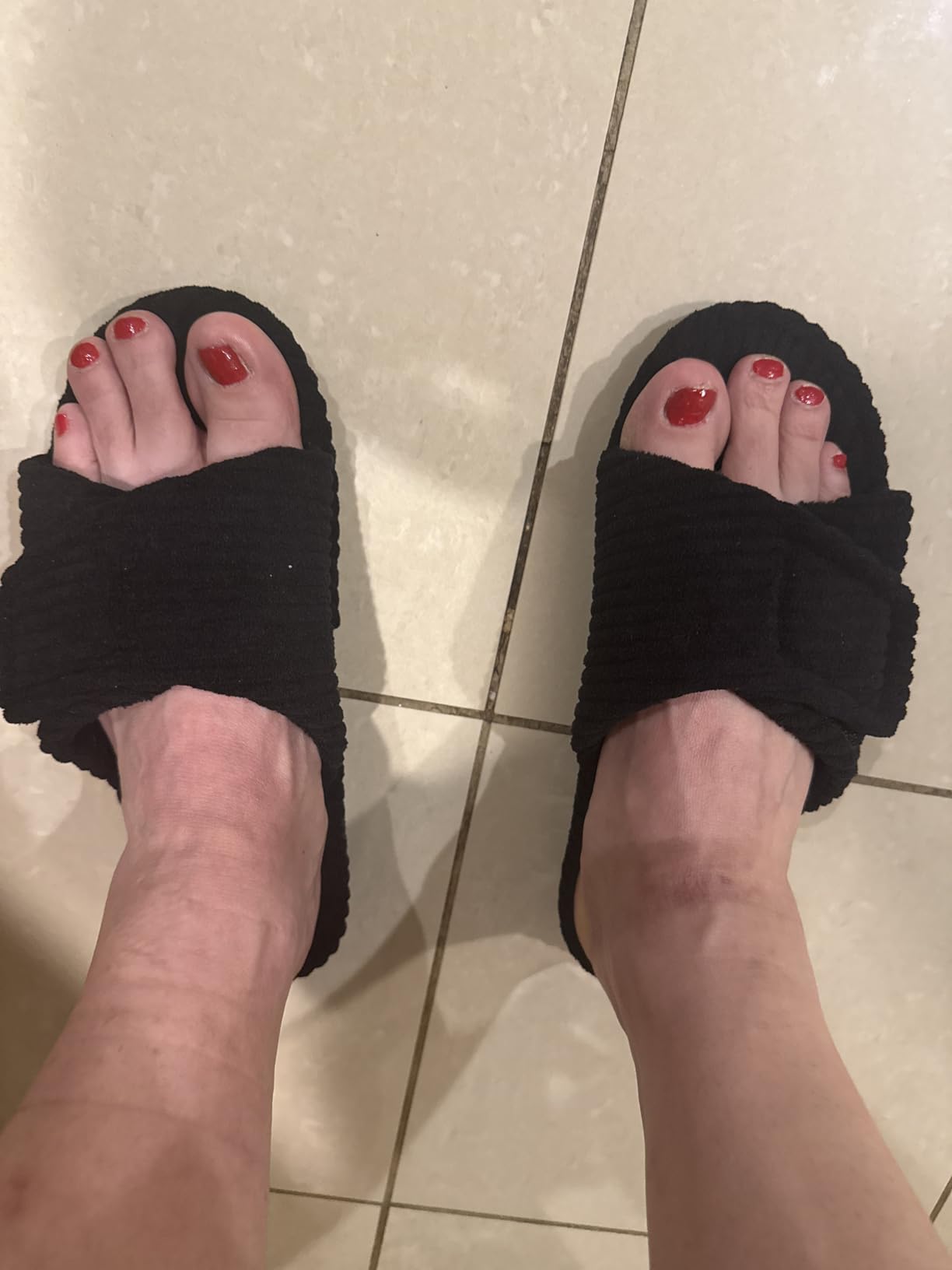 Litfun Orthopedic Slippers for Women Arch Support House Shoes customer photo 1