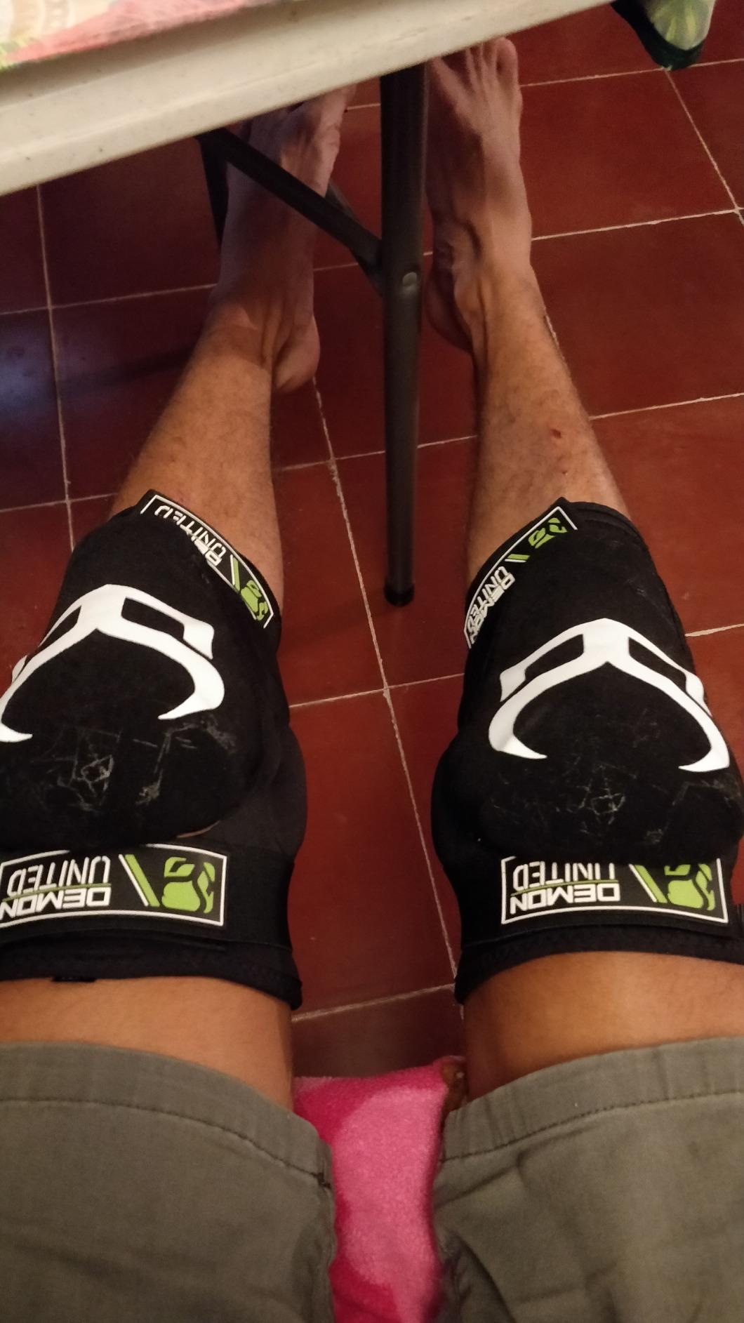Demon Hyper X D30 V3 Mountain Bike Knee pad | BMX | MX | Snowboard (Medium) customer photo 1